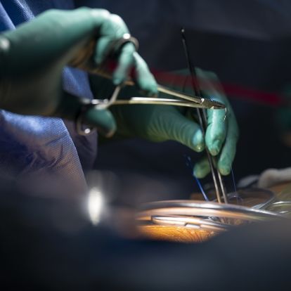 cardiac surgery