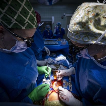 cardiac surgery