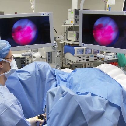 A bladder tumour as seen through a blue light scope.