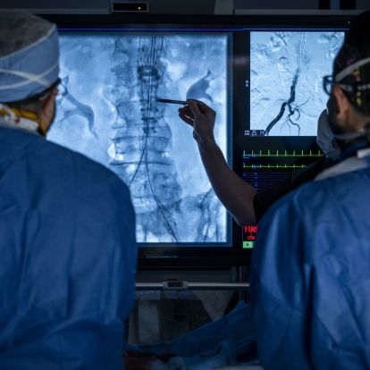 Shockwave 2 Surgical teams use image guided technology to complete a vascular procedure at KHSC