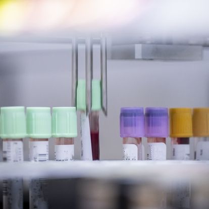 KHSC's laboratory robotics testing a series of blood vials. KHSC's laboratory robotics testing a series of blood vials.