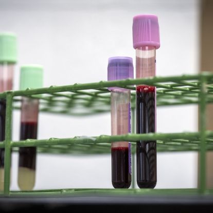 Low-volume vials next to the standard vials Low-volume collection tubes next to standard tubes.