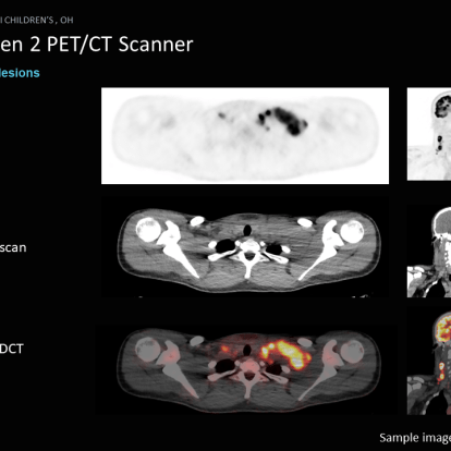 PET/CT sample scans