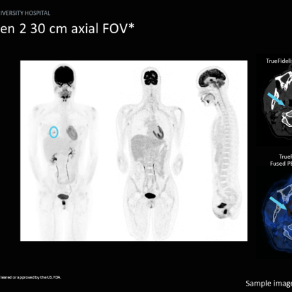 PET/CT sample scans