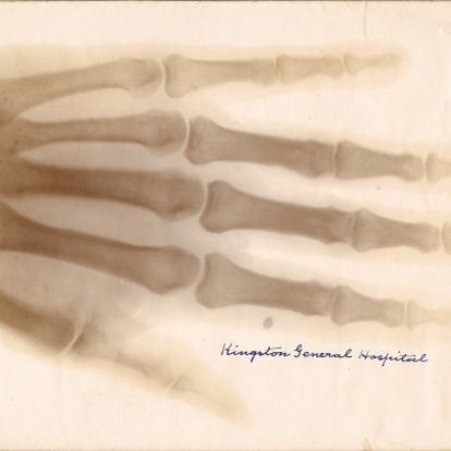 X-Ray Print (1896)