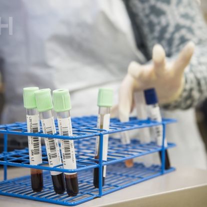 Image of specimens in our lab