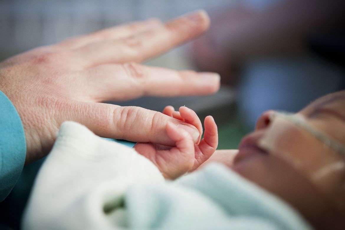 Parents participating in the study are encouraged to provide basic infant care earlier than before, such as skin-to-skin contact, feedings and diaper changes.