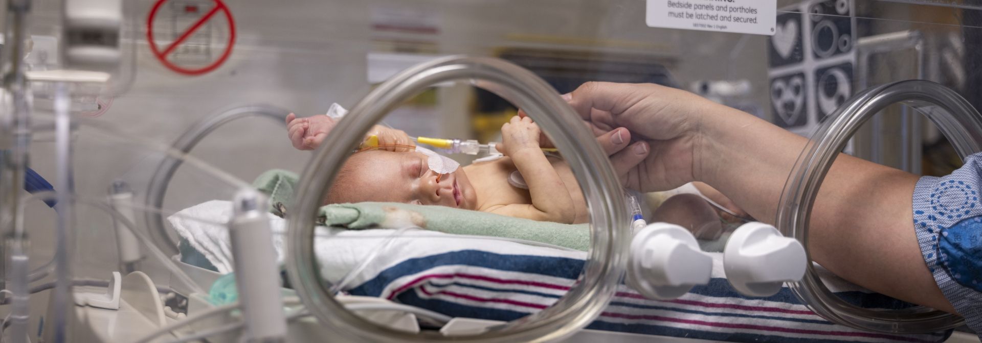 a baby in the NICU at KHSC