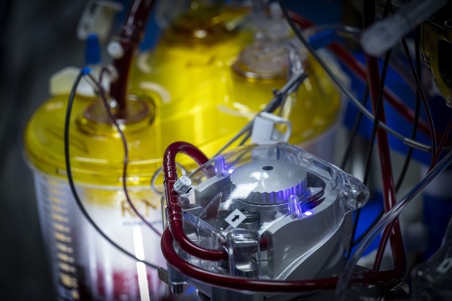 cardiac bypass machine