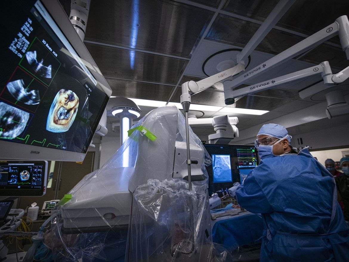 Mitral valve clip procedure in the hybrid OR.